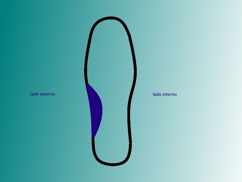 arco longitudinal externo ALE para plantillas ortopedicas