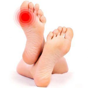 Metatarsalgia. Causas y síntomas 2 dolo plantar en el antepie