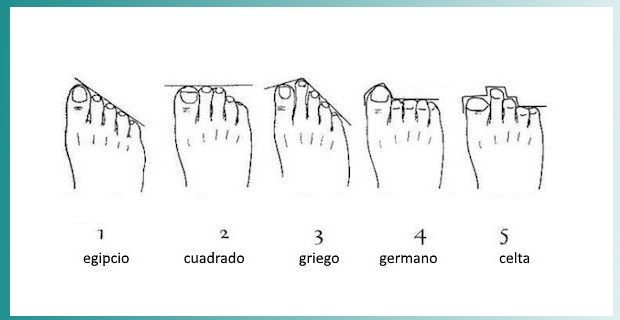Formas de pies 6 formas de pies