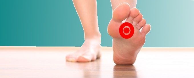 dolor neuroma de morton